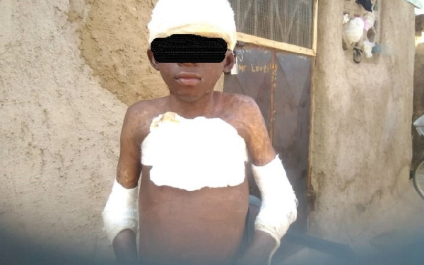 Man douses boy with petrol; sets him ablaze for peeping at woman in bathroom