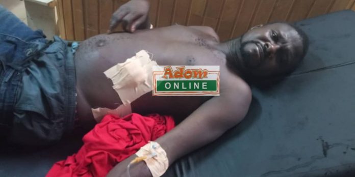Photos-Two-sustained-gunshot-wounds-at-dumsor-protest-at-Somanya-3-1024x512.jpeg