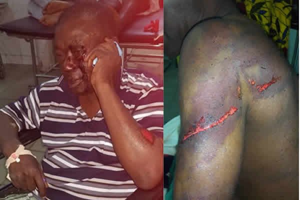 Chief Nana Kwasi Agyemang IX was brutalised by men allegedly hired by Nana Hema Dekye