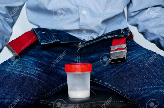 man with the analysis of semen in his hands