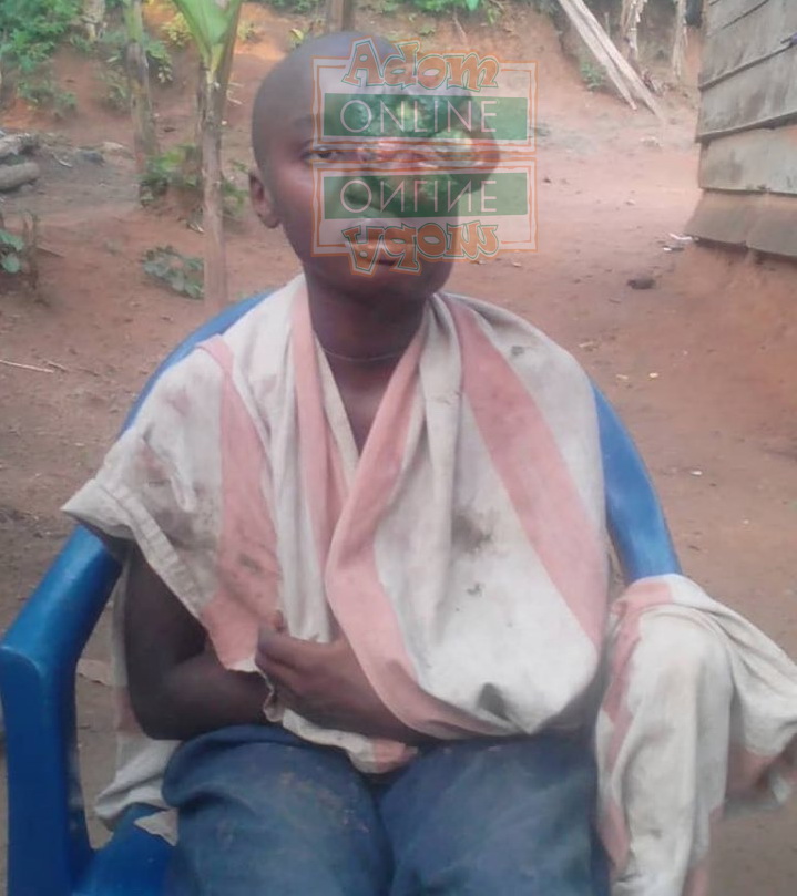 Boy, 14, loses eye after bat attack