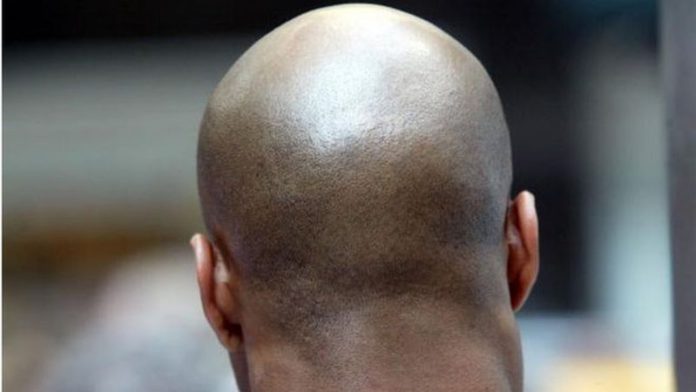 bald bald men