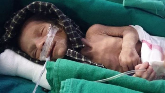 The newborn is recovering in hospital The newborn is recovering in hospital
