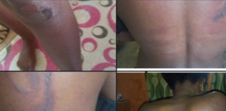 A Koforidua Circuit Court has granted bail to three persons in the sum of ¢30,000 and two sureties each for assaulting the Miss Commonwealth Beauty pageant Nana Ama Essien who was accused of stealing.