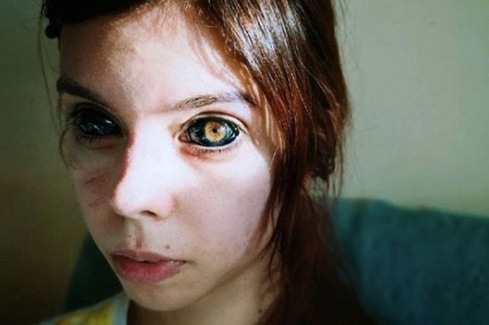 Eye