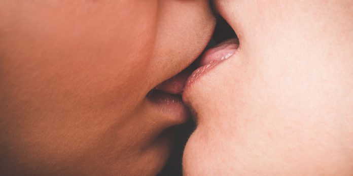 Kiss