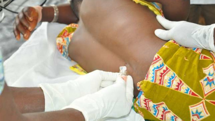 Meningitis is an inflammation of the meninges, the membranes covering the brain and spinal cord Meningitis is an inflammation of the meninges, the membranes covering the brain and spinal cord.