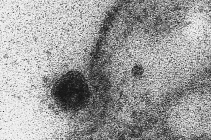 coronavirus cells coronavirus cells