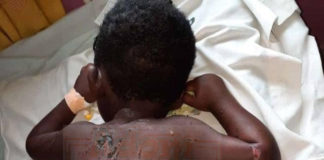 Father beats 3-year-old son with naked wire child abuse