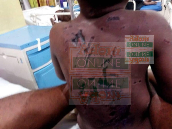Father beats 3-year-old son with naked wire child abuse Father beats 3-year-old son with naked wire child abuse