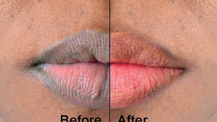 lips