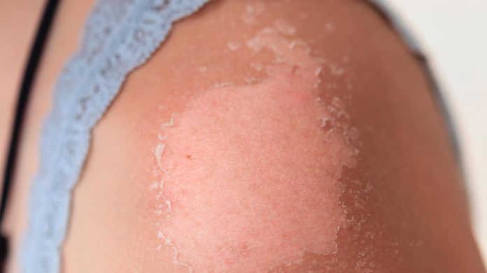 skin