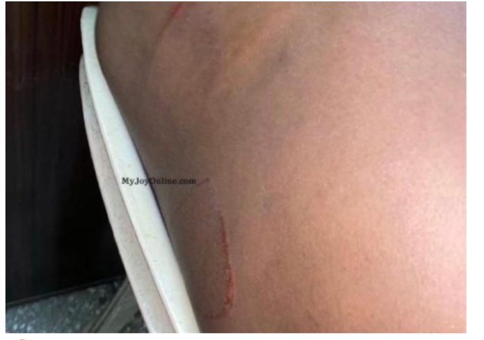 Keta MP-Elect attacked Keta MP-Elect attacked