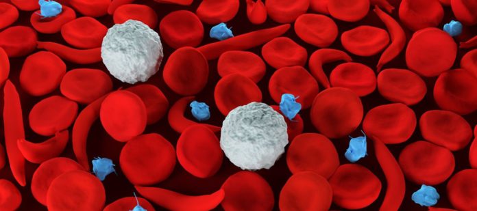 sickle cell