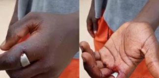 The young man wearing the 'sakawa' ring lives at Iron City in Kasoa