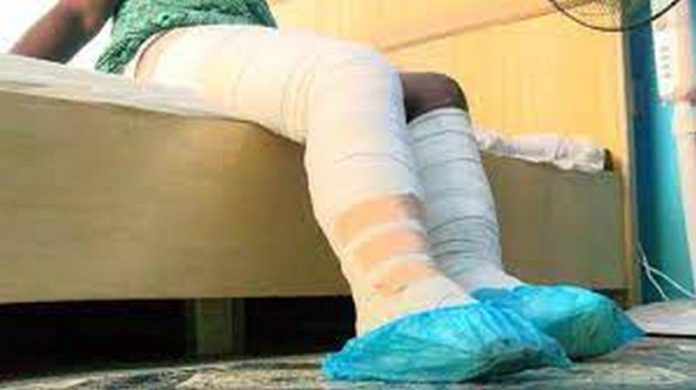 Lady whose boyfriend burnt son to death reeling under huge medical bills Lady whose boyfriend burnt son to death reeling under huge medical bills