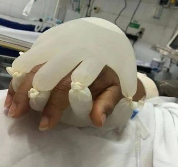 Fake hand
