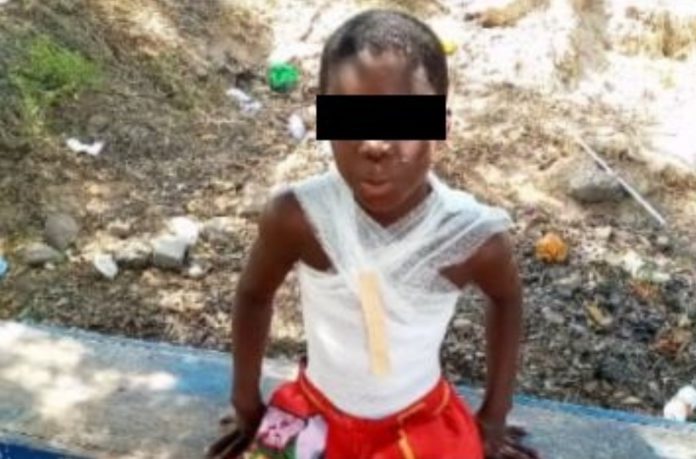 Boy set ablaze Ngleshie Amanfrom near Kasoa