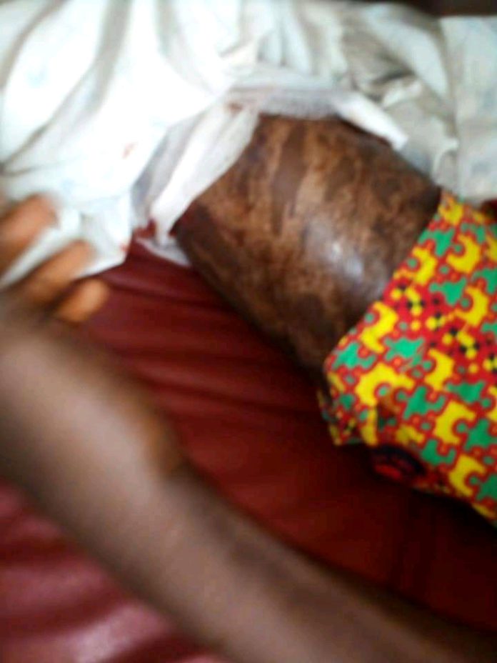 Five injured in Apam Police versus youth battle