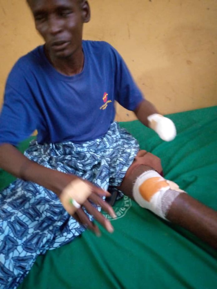 Herdsman attacks biological brother, chops off his wrist