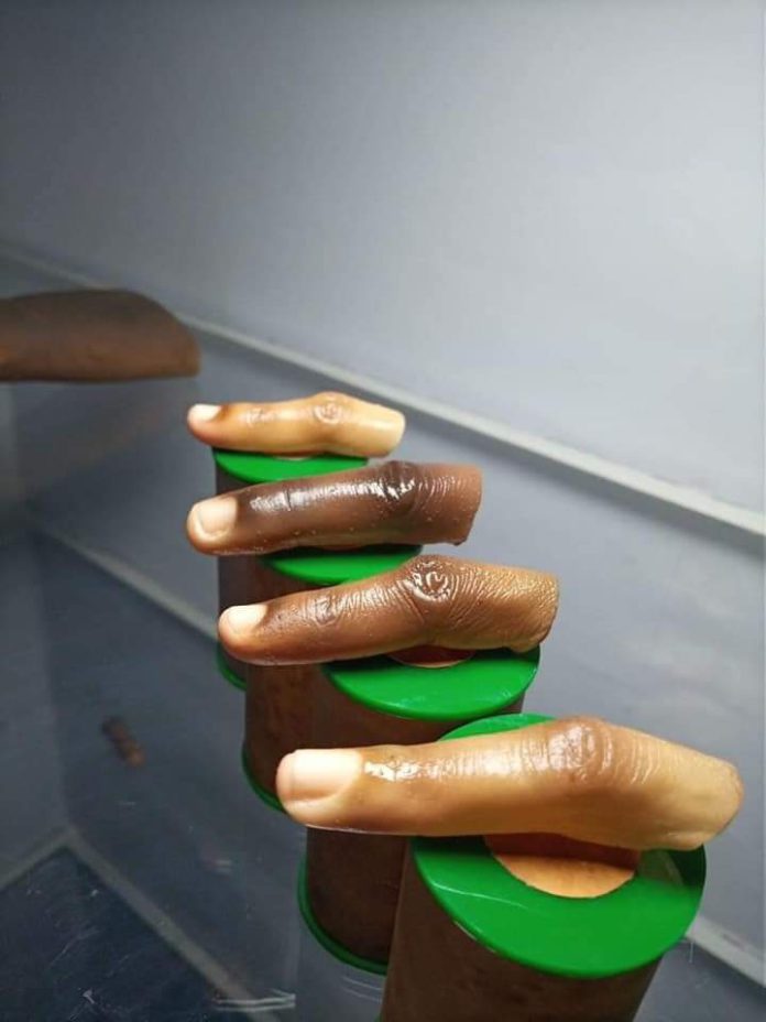 Dark-skinned prosthesis