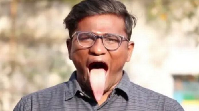 Tongue