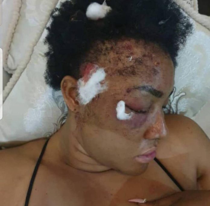 Angela okorie after assassination attempt