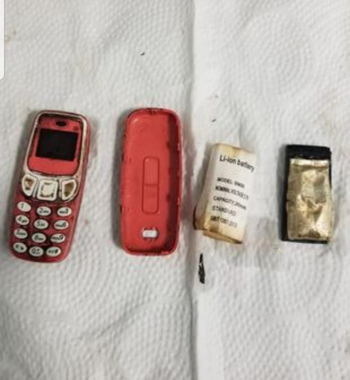 33-year-old man who swallowed Nokia phone undergoes surgery