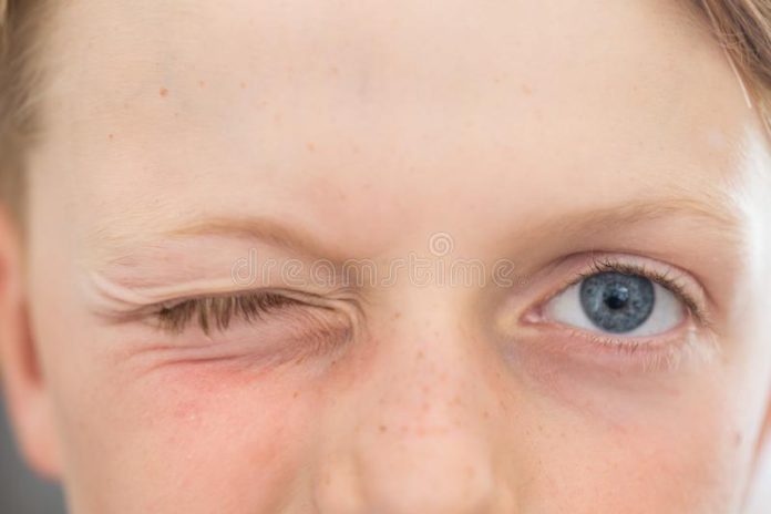 close-up-year-old-s-blue-eyes-close-up-year-old-s-blue-eyes-winking-one-eye-shut-other-open-137180495 (Copy)