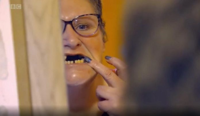 teeth