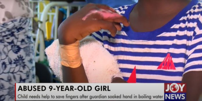 Domestic-violence-hand-soaked-in-boiling-water-845x424