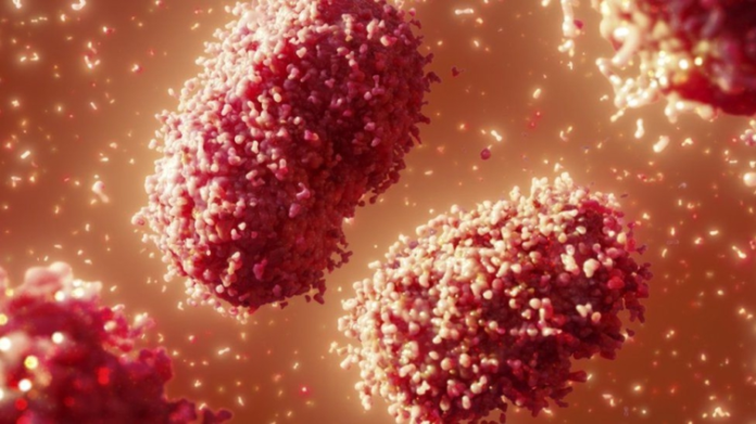 Monkeypox is similar to smallpox but less severe and less infectious too - Image Source: SCIENCE PHOTO LIBRARY Monkeypox is similar to smallpox but less severe and less infectious too - Image Source: SCIENCE PHOTO LIBRARY