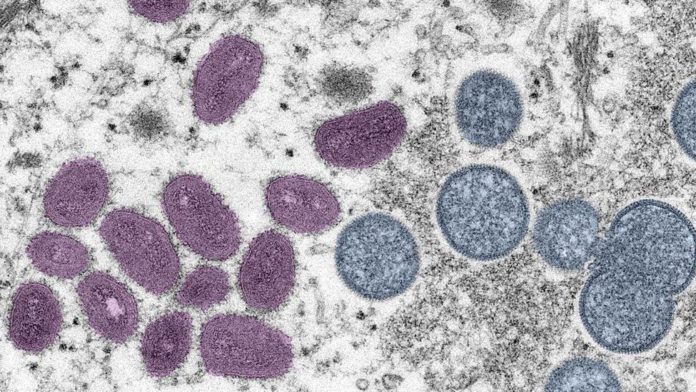 Monkeypox vaccine outlined / Credit: GETTY IMAGES