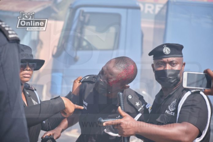 Police-injured (Copy)