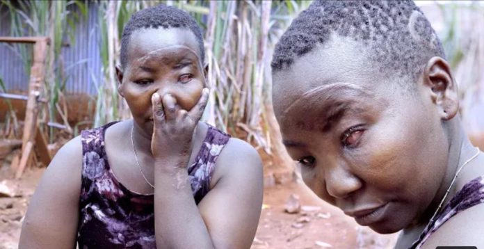 Moureen Omolo after attempted murder by husband