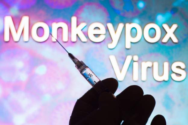 Monkeypox Monkeypox