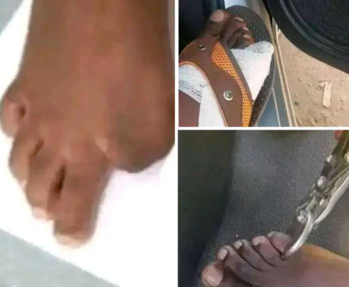 Unverified screenshots spreading around on WhatsApp, Twitter, and Facebook suggest that some sell their toes for as much as US$40,000 for the big toe, US$25,000 for the middle toe and US$10,000 for the tiny toe. Unverified screenshots spreading around on WhatsApp, Twitter, and Facebook suggest that some sell their toes for as much as US$40,000 for the big toe, US$25,000 for the middle toe and US$10,000 for the tiny toe.