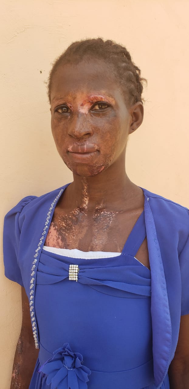 Woman bathe with acid