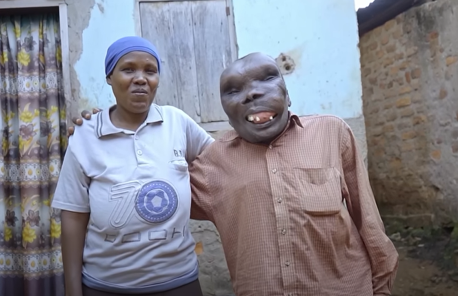 Godfrey Baguma Ugliest man in the world , and his wife, Kate