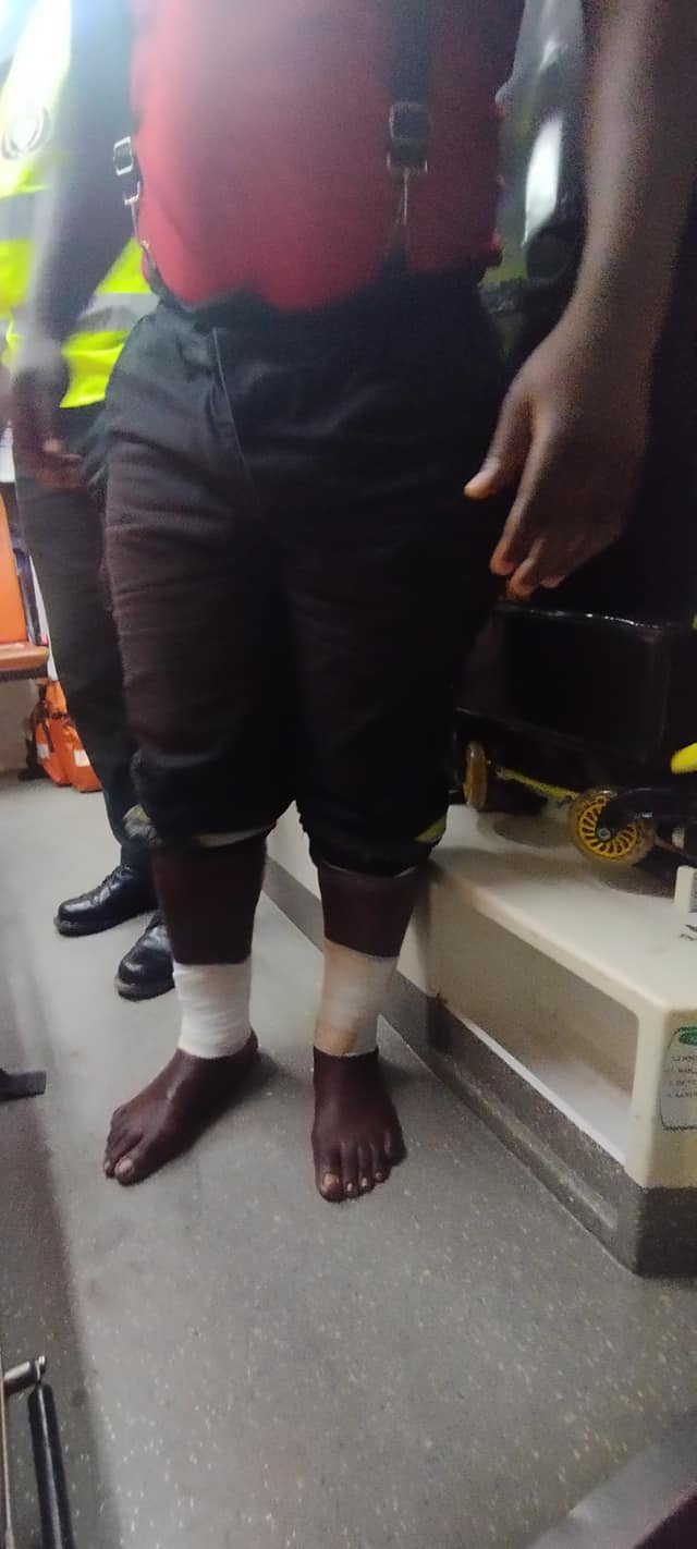 CM injured fire