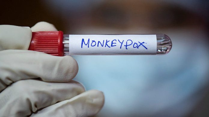 Monkeypox virus / Credit: GETTY IMAGES