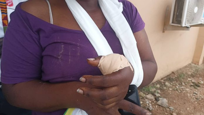 Woman escapes death after 4 thugs attacked her on Gomoa highway