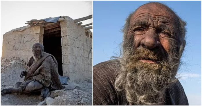 World dirtiest man dies shortly after taking first bath in decades