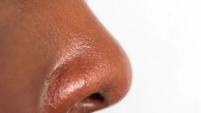 Treating oily nose Treating oily nose
