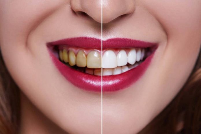 teeth teeth