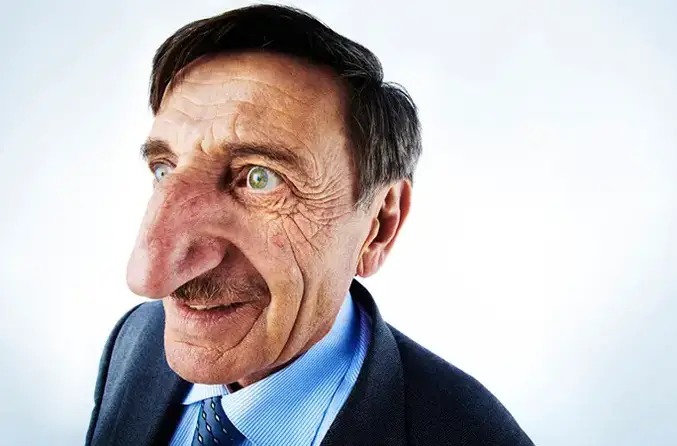 Man with world’s longest nose dies suddenly at age 75