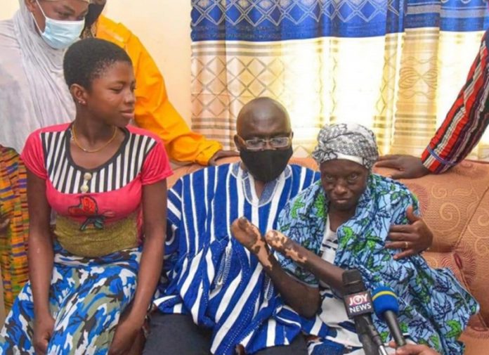 leper-bawumia (Copy)