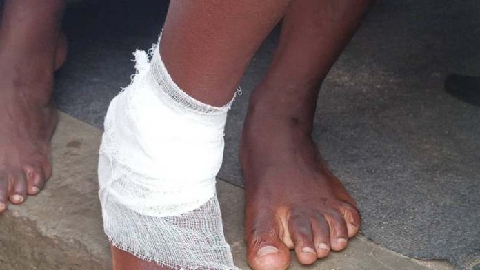 STRAY DOG BITE STRAY DOG BITE