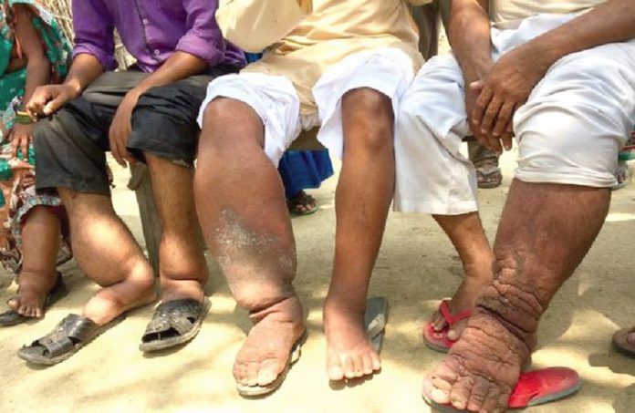 elephantiasis_compressed_1615x1050