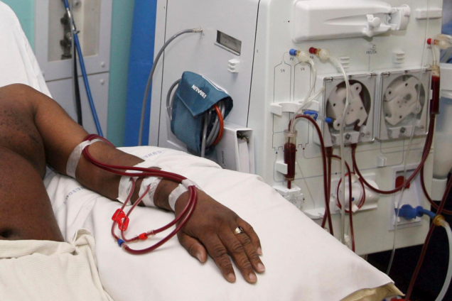 Kidney-dialysis-636x424